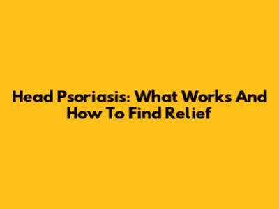 Head Psoriasis: What Works And How To Find Relief