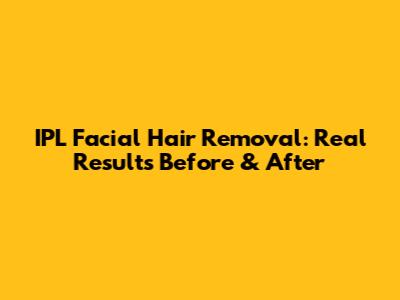 IPL Facial Hair Removal: Real Results Before & After