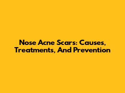 Nose Acne Scars: Causes, Treatments, And Prevention