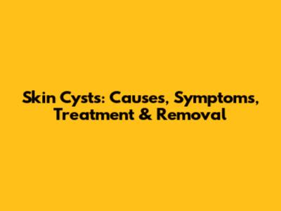 Skin Cysts: Causes, Symptoms, Treatment & Removal